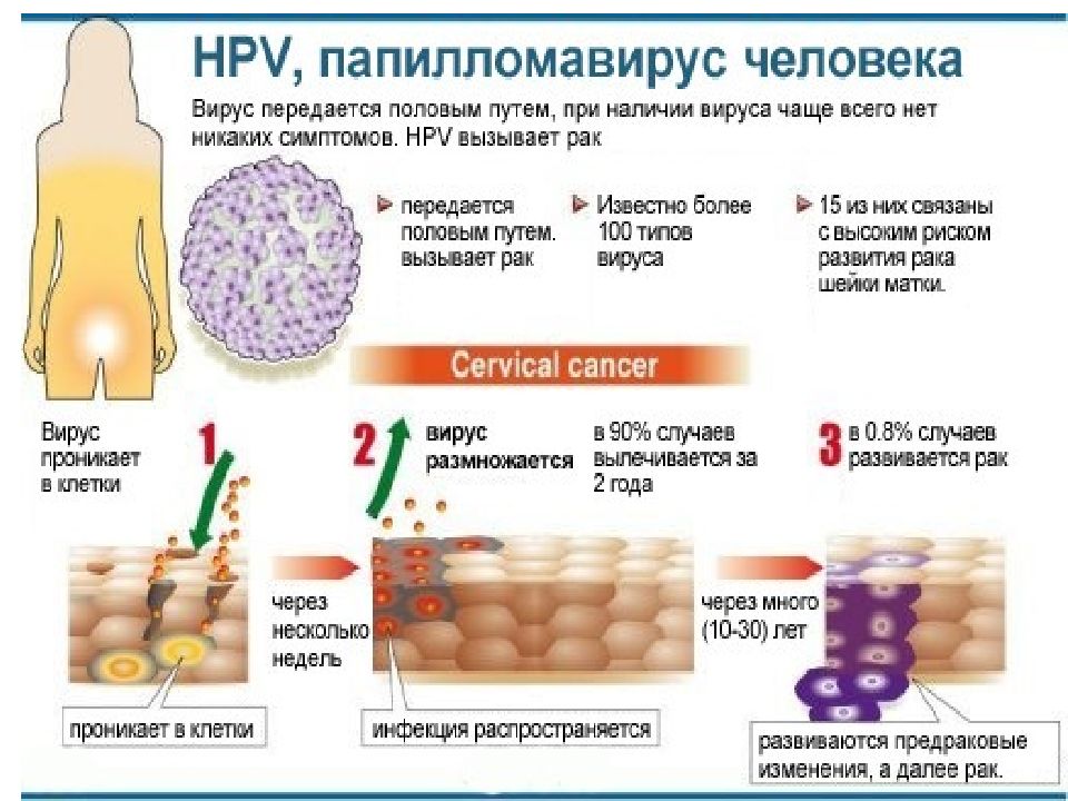 Типы вируса папилломы. Вирус папилломы человека высокого онкогенного риска. Папилломавируса человека. Папилломавирус пути передачи. ВПЧ онкогенного типа.