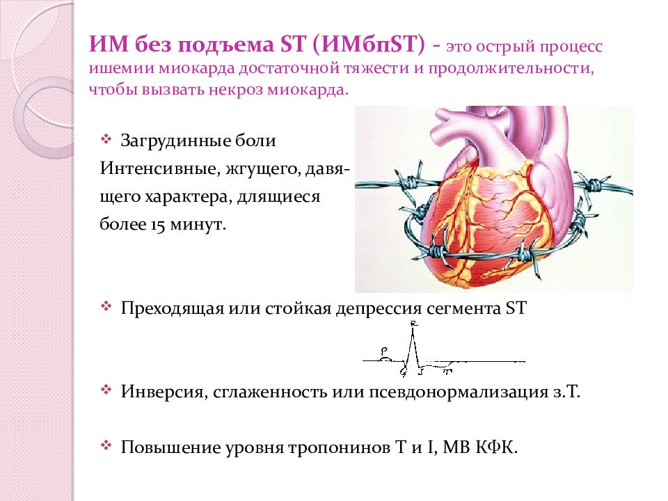 Презентация окс без подъема st