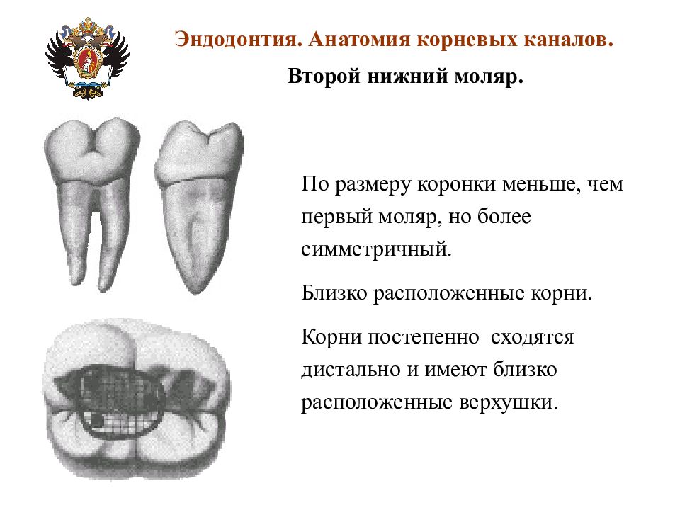 Анатомия каналов. Второй моляр нижней челюсти анатомия корневых каналов. Нижний моляр анатомия корневых каналов. Первый верхний моляр корневые каналы. Первый Нижний моляр корни.