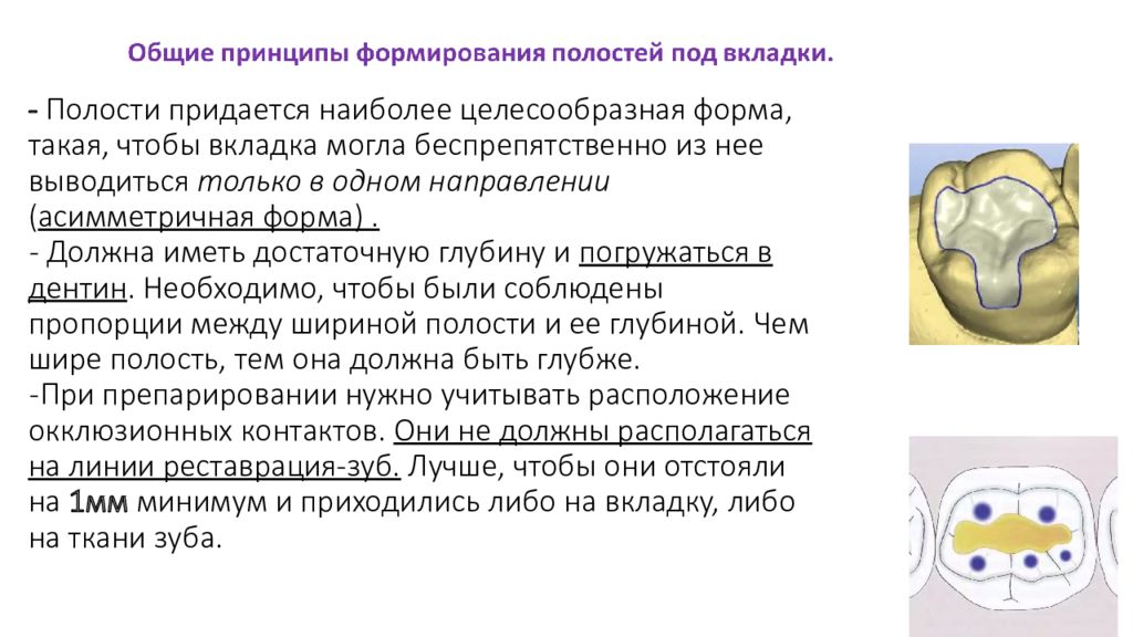 Виды вкладок. Формирование полости под вкладку. Принципы формирования полостей под вкладки. Общие принципы формирования полостей под вкладки. Основные принципы формирования полостей для вкладок.