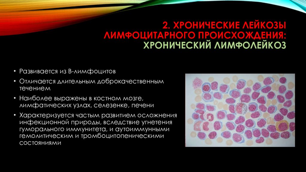Лейкоз характеризуется. В -лимфоциты хронический лимфолейкоз. Лимфоцит хронический лейкоз. Хронический миелоидный лейкоз осложнения.