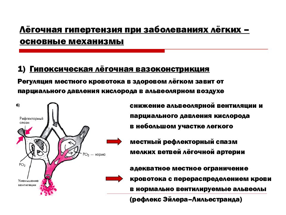 Легочная артериальная гипертензия презентация