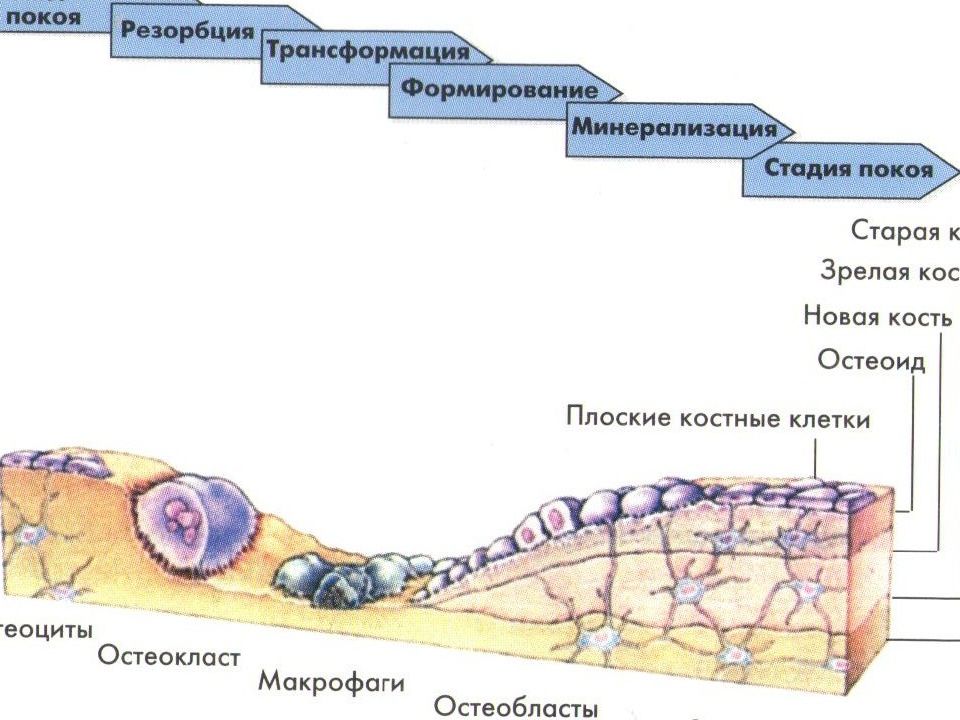 Презентация на тему миеломная болезнь