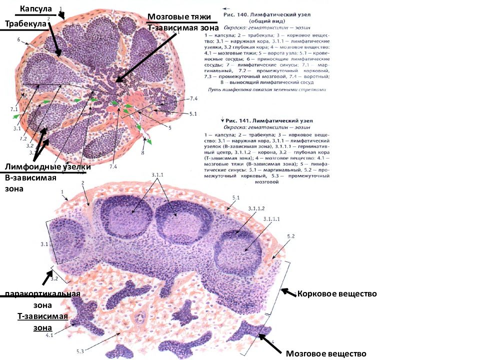 Зоны вещества. Мозговое вещество лимфатического узла гистология. Трабекула лимфатического узла гистология. B зависимая зона лимфатического узла. Т И В зоны лимфатического узла.