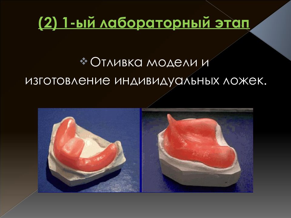 Индивидуальные ложки в ортопедической стоматологии презентация