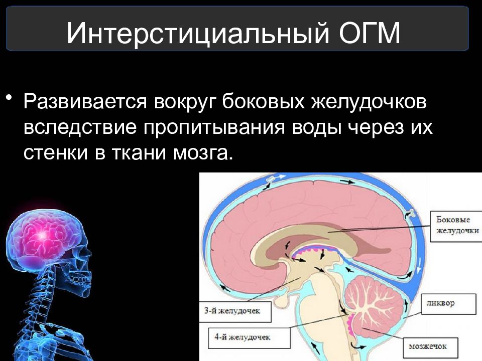 Отек мозга презентация