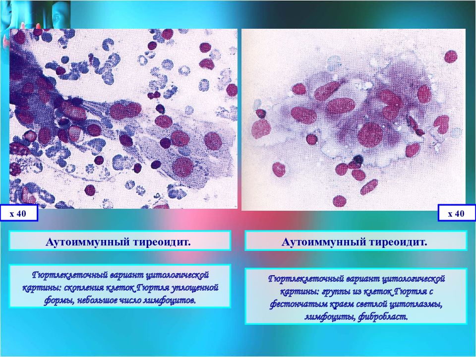 Цитологическая диагностика заболеваний молочной железы презентация