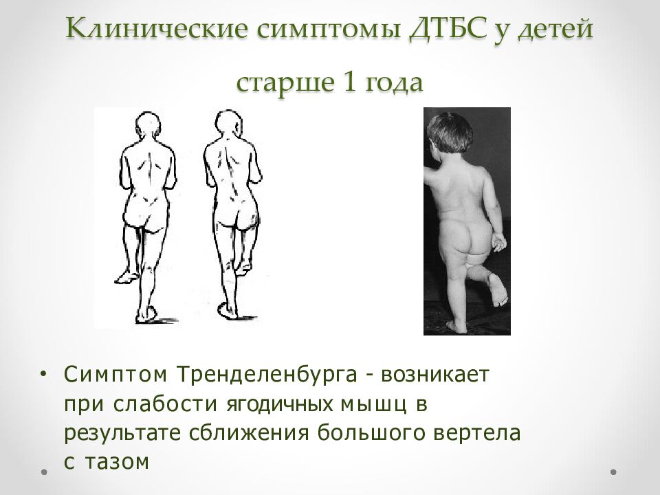 Клинические симптомы ДТБС у детей старше 1 года