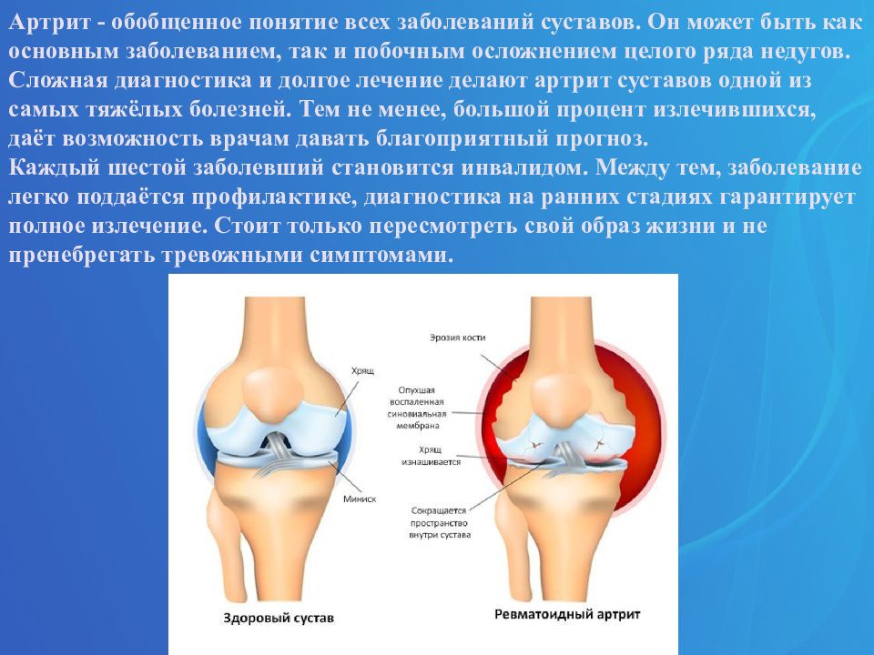 Заболевания опорно-двигательного аппарата. Заболевания опорно-двигательного аппарата презентация. Заболевания опорно-двигательного аппарата список. Симптомы заболеваний опорно-двигательного аппарата.