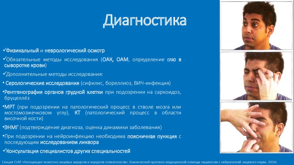 Парез лицевого нерва мкб 10. Методы исследования лицевого нерва неврология. Физикальный неврологический осмотр. Нейропатия лицевого нерва неврология.