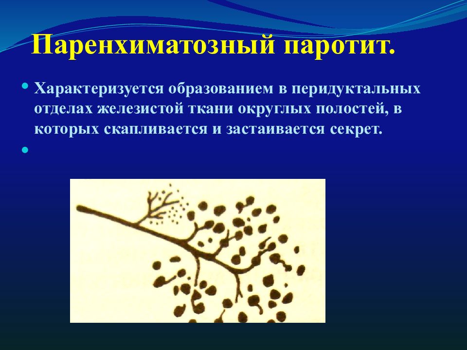 Паротит хронический. Паренхиматозный паротит. Хронический неспецифический паренхиматозный паротит. Хронический паренхиматозный паротит у детей презентация. Хронический паренхиматозный паротит у детей.