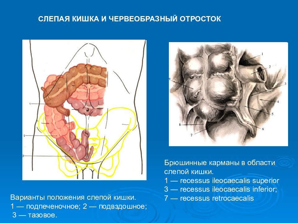 Червеобразный отросток варианты расположения строение Лекция № 9 Топографическая анатомия и оперативная хирургия тонкого и толстого - 