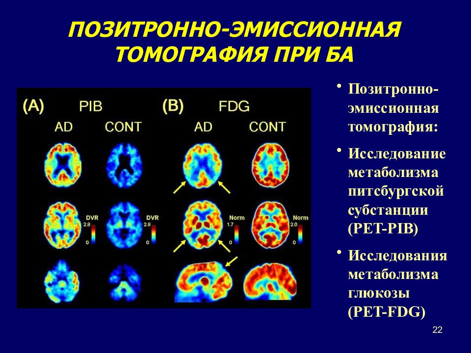 Методы позитронно эмиссионной томографии