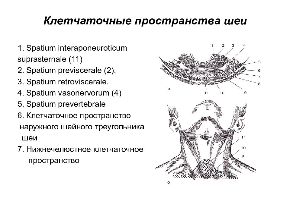 Spatium retropharyngeum. Клетчаточные пространства шеи. Клетчаточное пространство наружного шейного треугольника. Пространства шеи анатомия. Топографическая анатомия шеи.