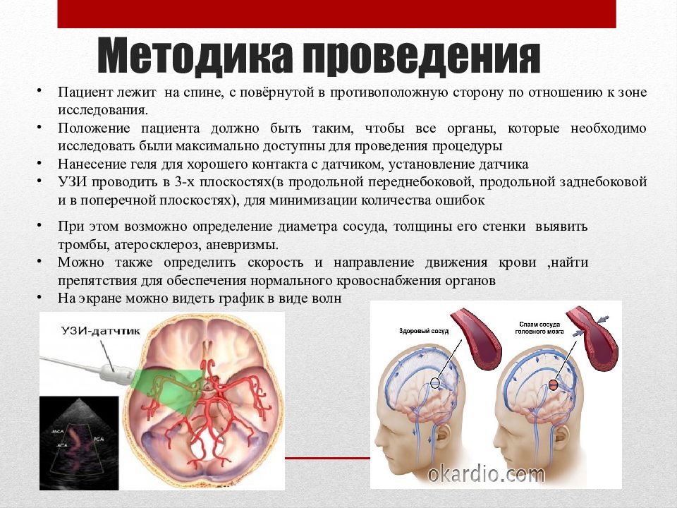 Отдел брахиоцефальных артерий