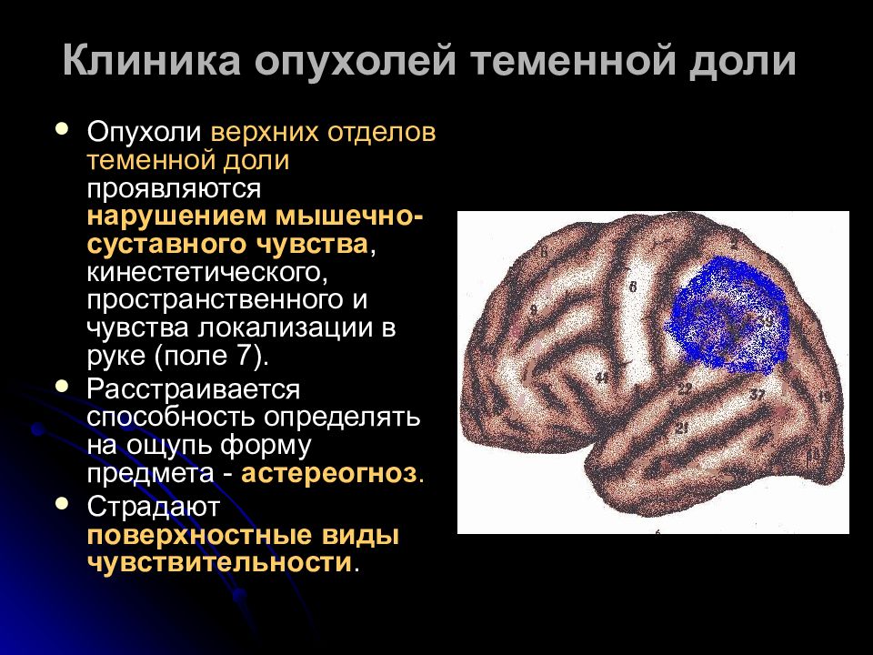 Расстройство схемы тела отмечается при поражении теменной доли доминантного полушария