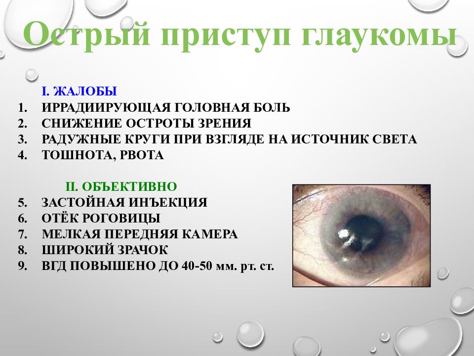 Что нельзя делать при глаукоме. Клинические проявления глаукомы. Презентация на тему глаукома. Клинические симптомы глаукомы.