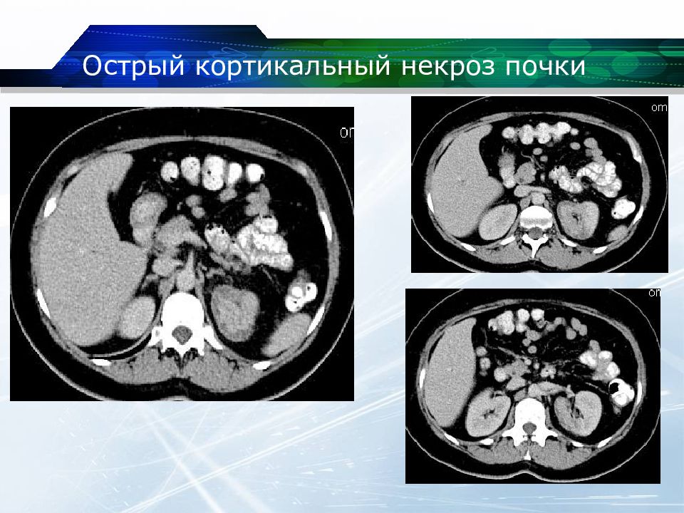 Кт почек презентация