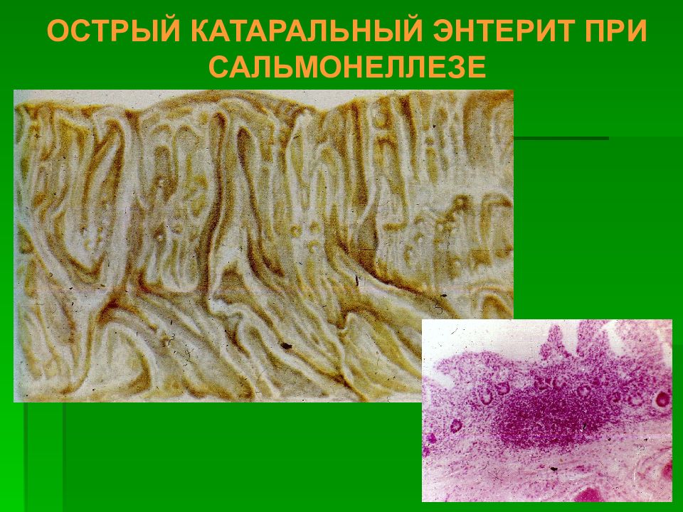 Сальмонеллез презентация патанатомия