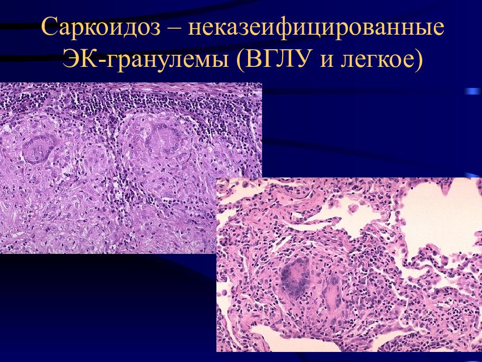 Воспаление патанатомия презентация