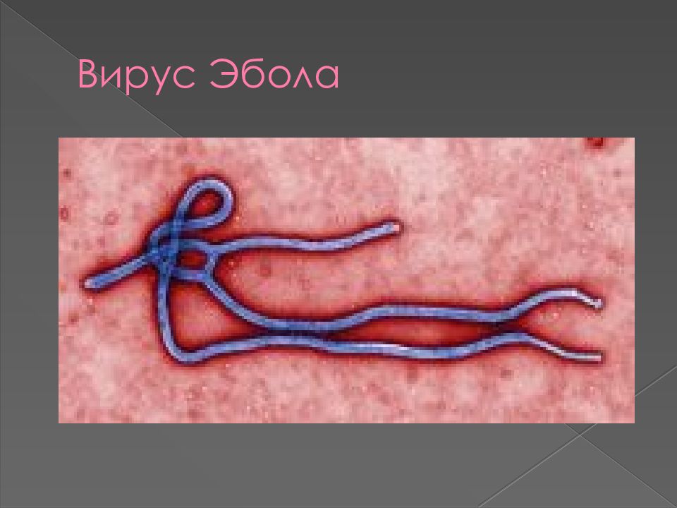 Вирус эбола презентация микробиология