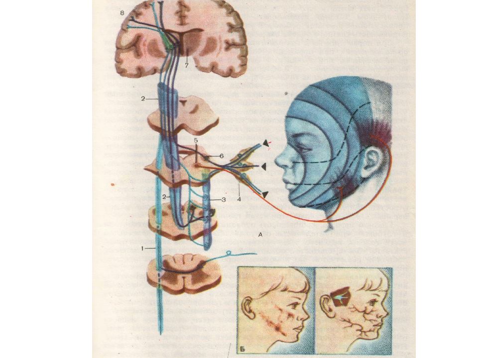 Поражение 12 пары черепных нервов. 5 Пара ЧМН. Черепно мозговые нервы презентация. Блокада черепных нервов.