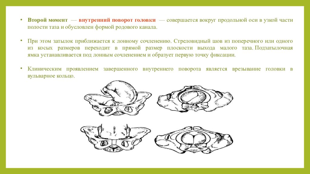 Пособие при затылочном предлежании. Точки фиксации при переднем виде затылочного предлежания. Биомеханизм родов при переднем виде затылочного предлежания. Биомеханизм родов при заднем виде затылочного предлежания. Биомеханизм родов при переднем и заднем виде затылочного предлежания.