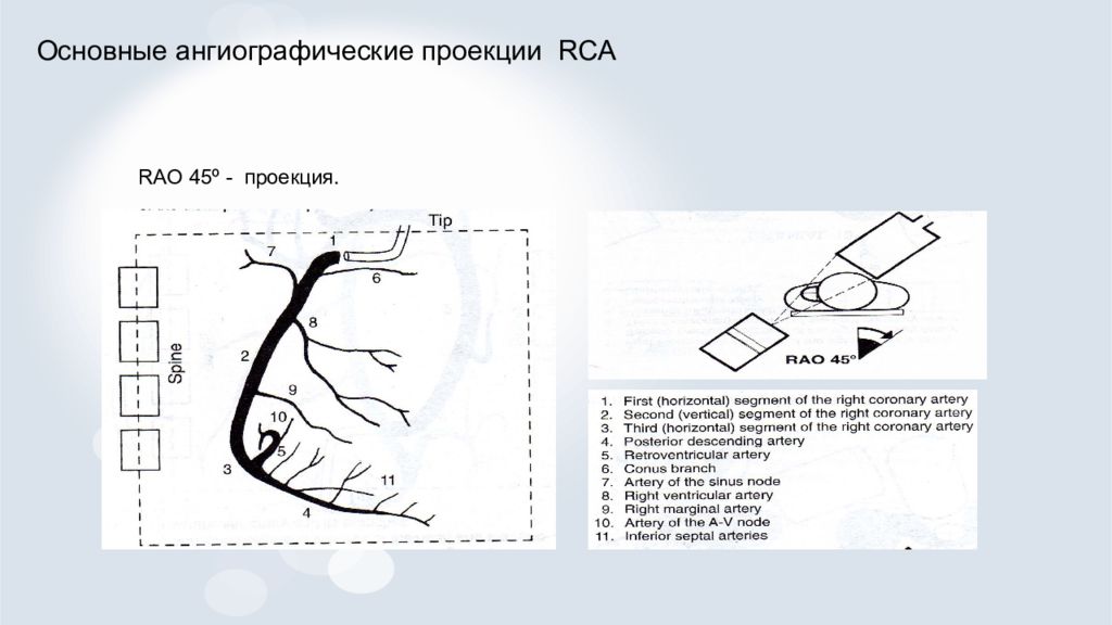 Рентгенэндоваскулярная диагностика презентация