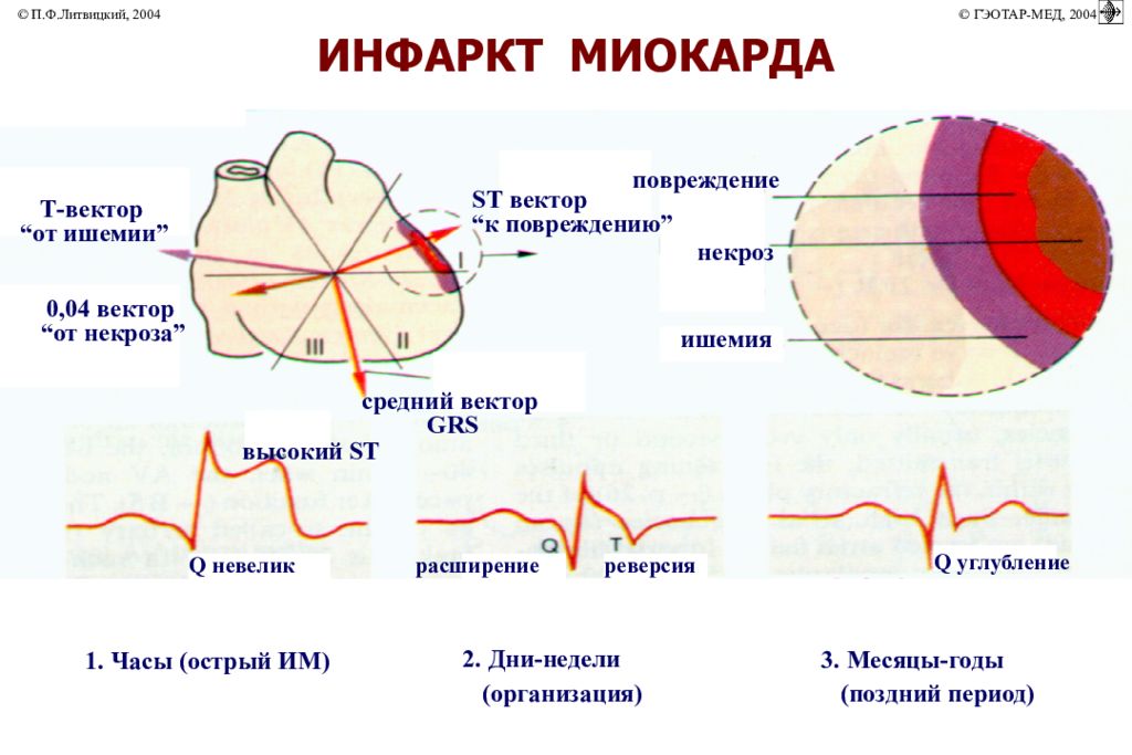 Коронарная недостаточность патофизиология презентация