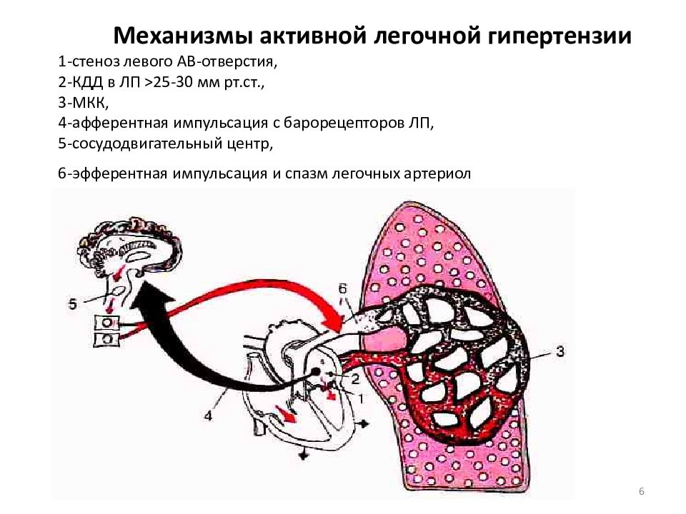 Механизмы активности. Гипертензия малого круга кровообращения причины. Активная и пассивная легочная гипертензия. Первичная легочная гипертензия схема. Механизм легочной гипертензии.