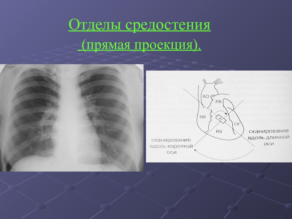 Лучевая диагностика средостения презентация