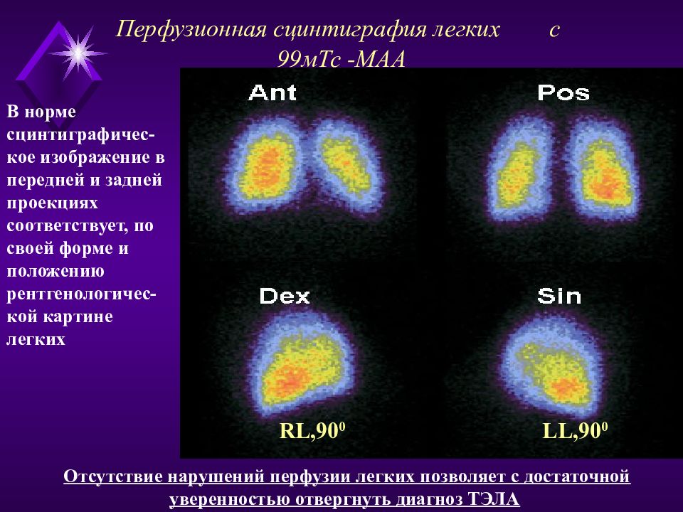 Сцинтиграфия щитовидной железы это