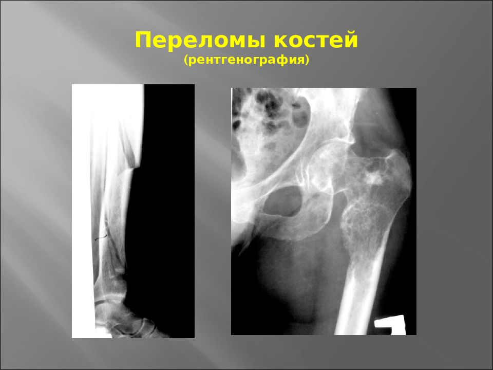 Основы травматологии презентация