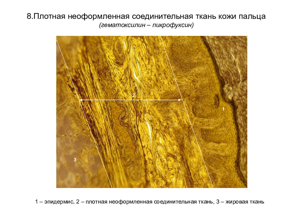 По изображению с микроскопа в препарате кожи пальца в плотной соединительной ткани