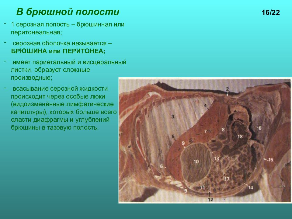 Рак брюшной полости. Спланхнология брюшина. Брюшина макропрепарат. Серозная оболочка брюшной полости.