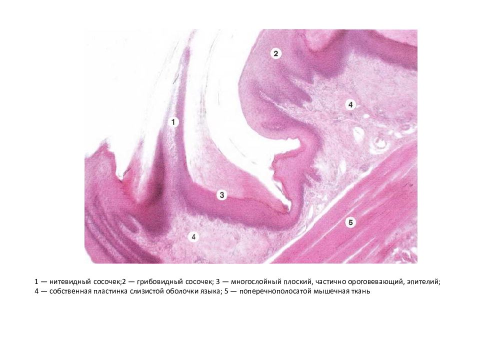 Пластинка слизистой. Нитевидный сосочек языка гистология. Нитевидные сосочки гистология препарат. Нитевидные сосочки языка препарат. Язык гистология препарат.