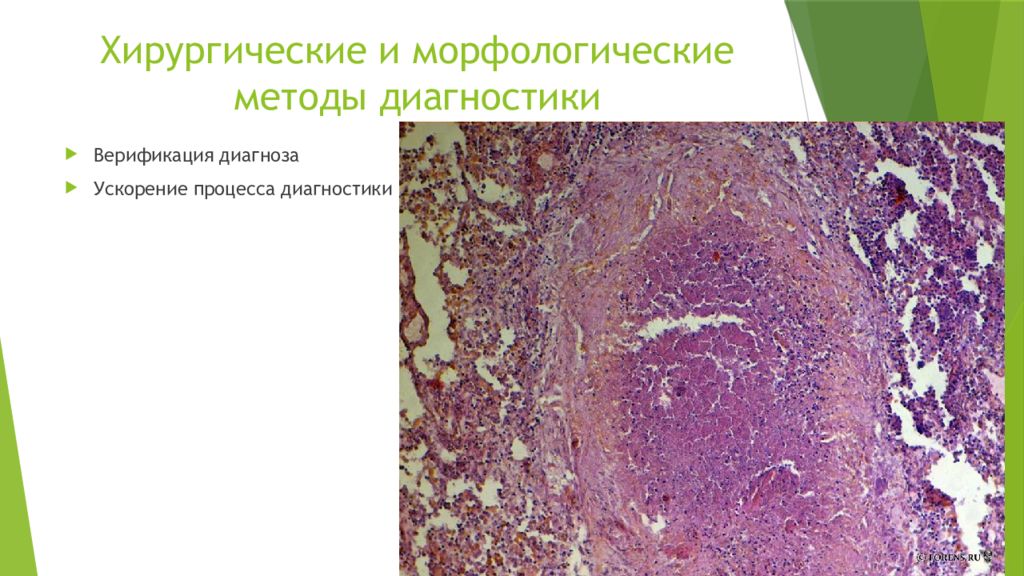 Лекарственные поражения легких презентация