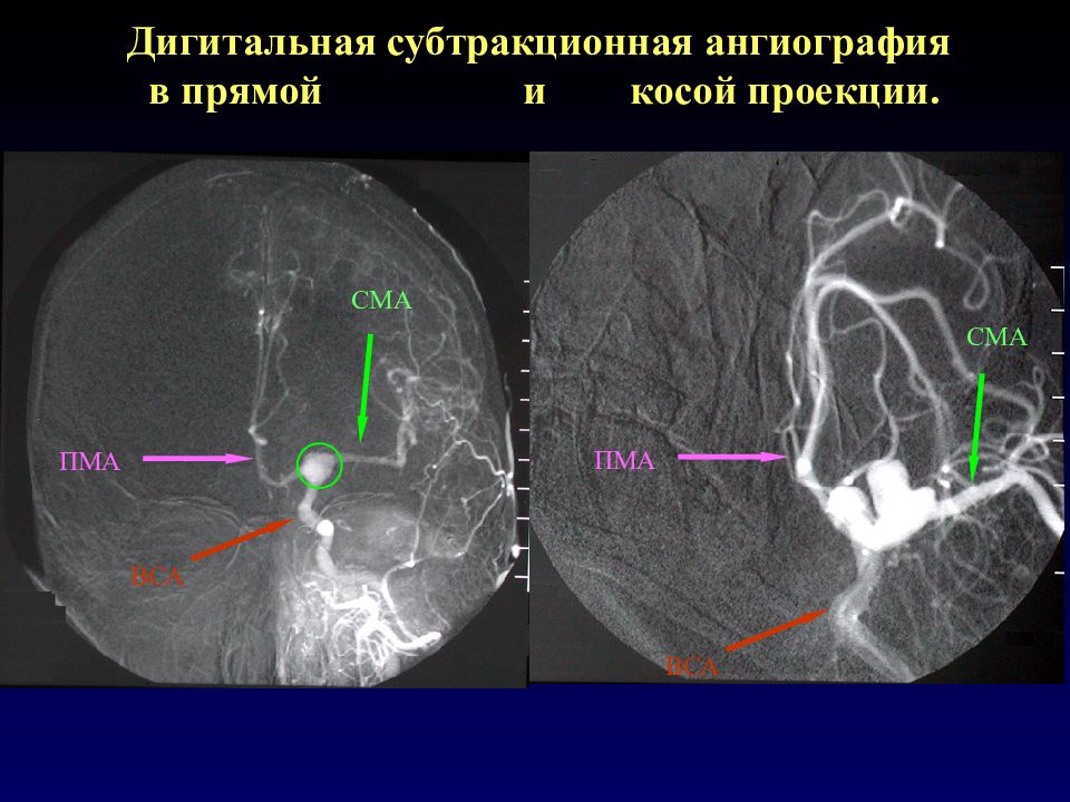 дигитальное исследование это. субтракционная ангиография. прямая субтракционная ангиография. контрастная субтракционная ангиография. субтракционная ангиография.