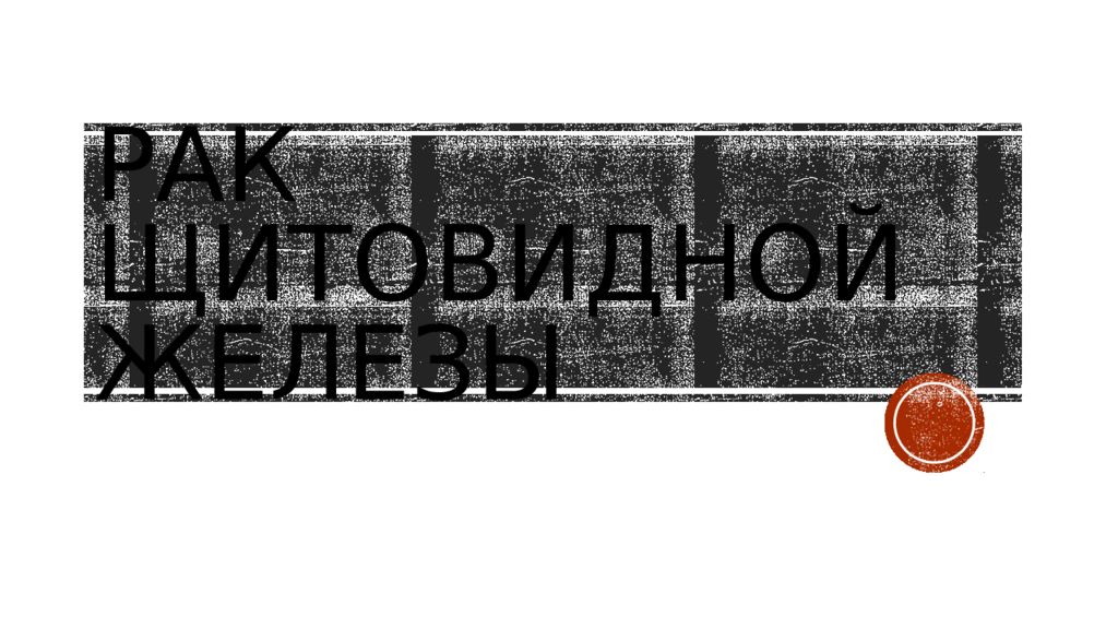 Рак Щитовидной железы