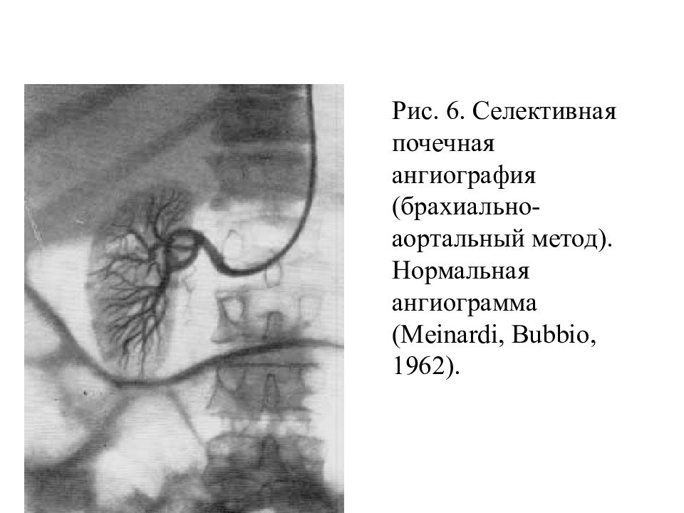 Почечная ангиография презентация