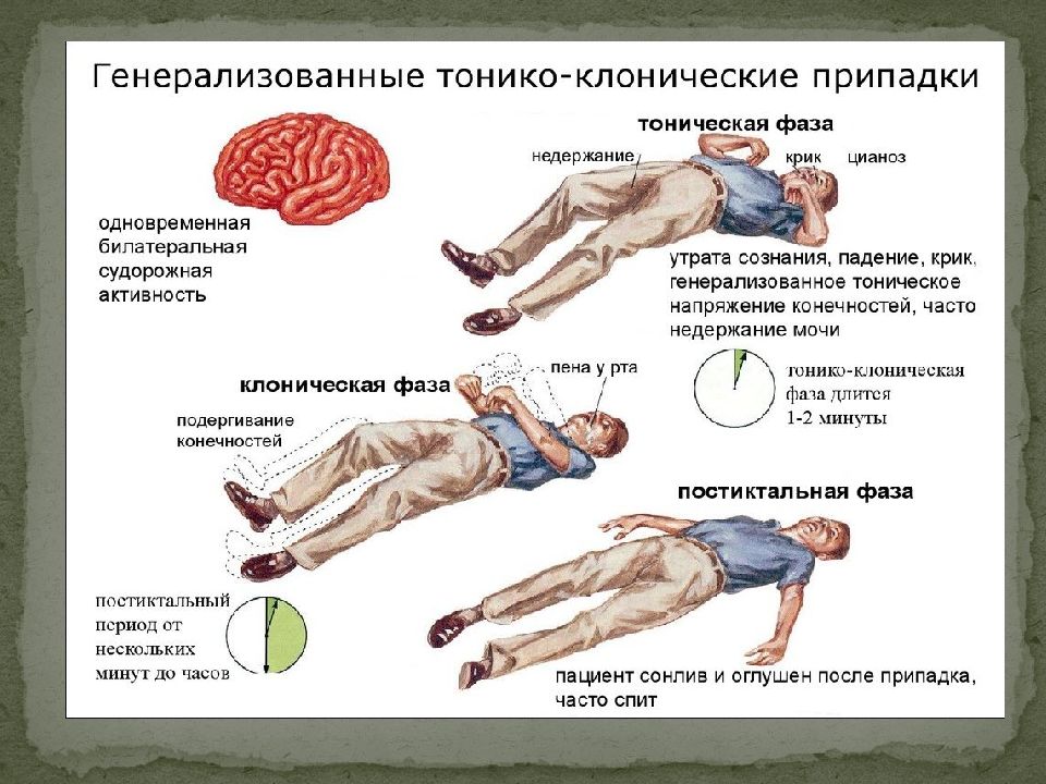 Судороги картинки для презентации