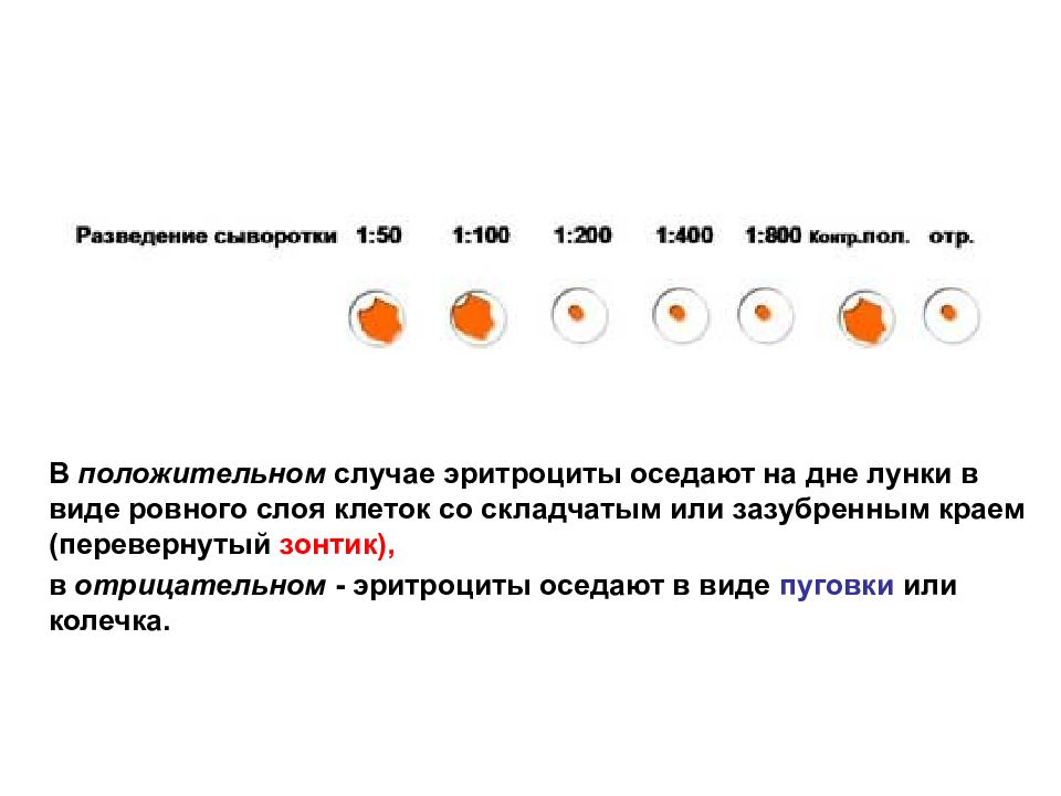 Положительные случаи. Эритроциты оседают на дно лунки. Пуговка и зонтик эритроциты. Эритроциты в реакции которые оседают в виде пуговки. Почему эритроциты не оседают.