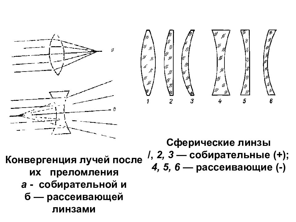 Презентация аномалии рефракции