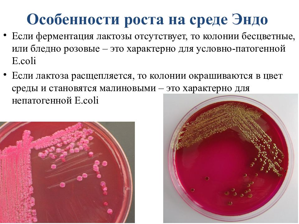 Кишечная палочка презентация микробиология