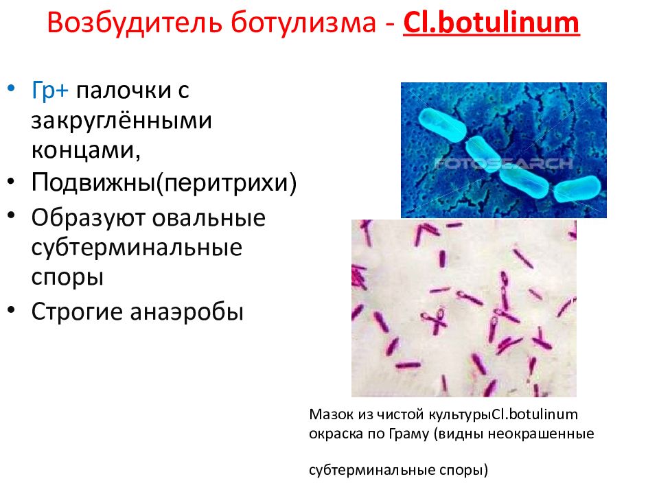 Возбудитель газовой гангрены рисунок