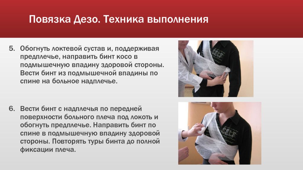 Техника наложения повязки дезо. Наложение повязки Дезо алгоритм. Технику наложения повязки Дезо.. Повязка Дезо алгоритм. Повязка Дезо техника наложения.