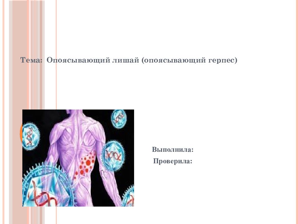 Тема: Опоясывающий лишай (опоясывающий герпес) Выполнила : Проверила :