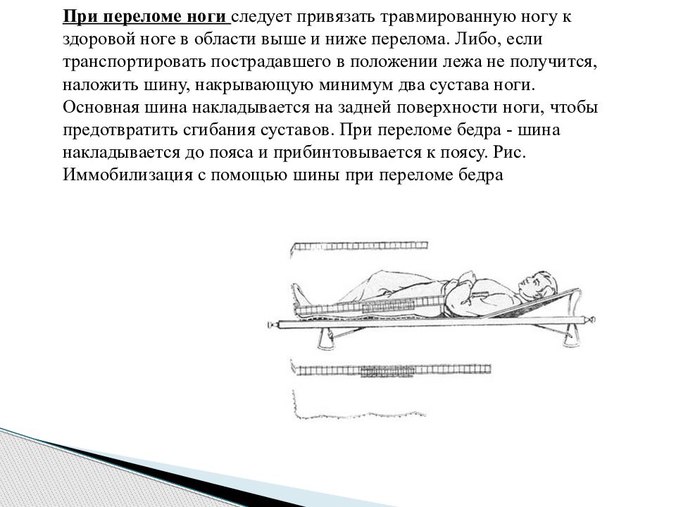 Первая помощь при переломе транспортировка пострадавшего. Производственная травма перелом ноги. При переломах конечностей только в положении лежа. Примотал травмированную ногу к здоровой ноге. При переломе ноги привязать друг к другу.