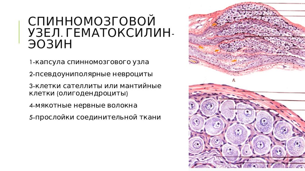 Узелки клеток. Строение спинномозгового ганглия гистология. Мякотные нервные волокна препарат гистология. Спинномозговой узел мантийные глиоциты. Клетки сателлиты гистология.