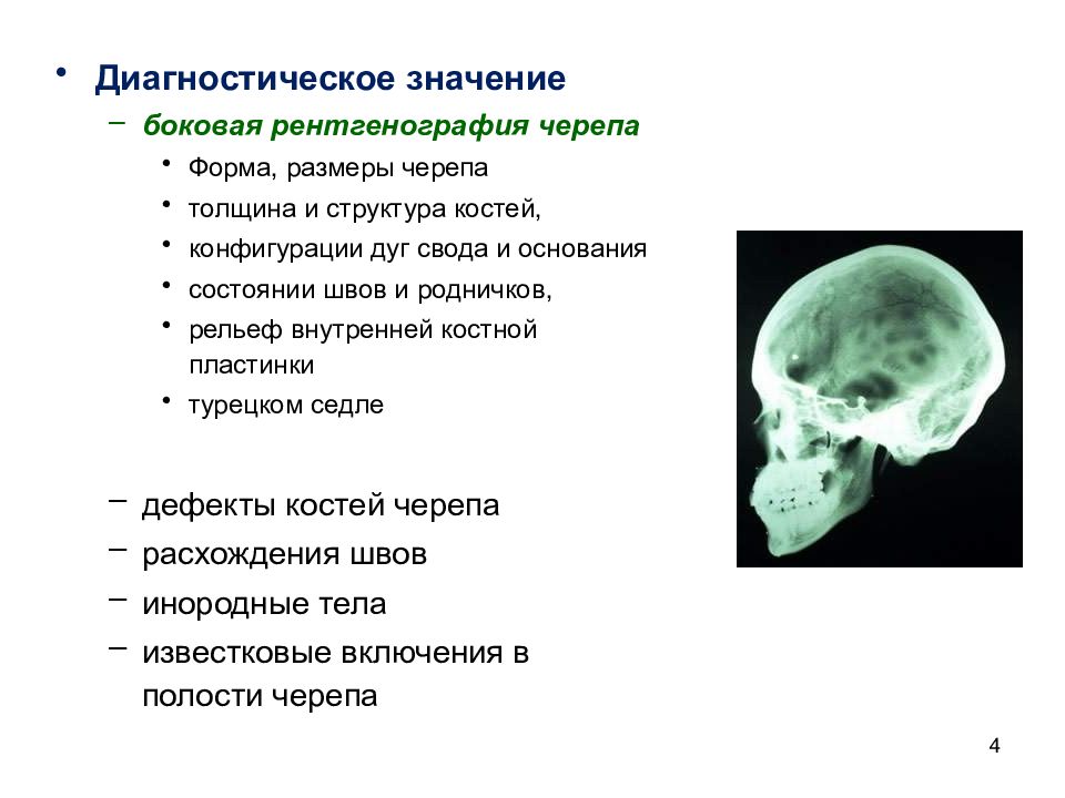 Усиление сосудистого рисунка черепа что значит